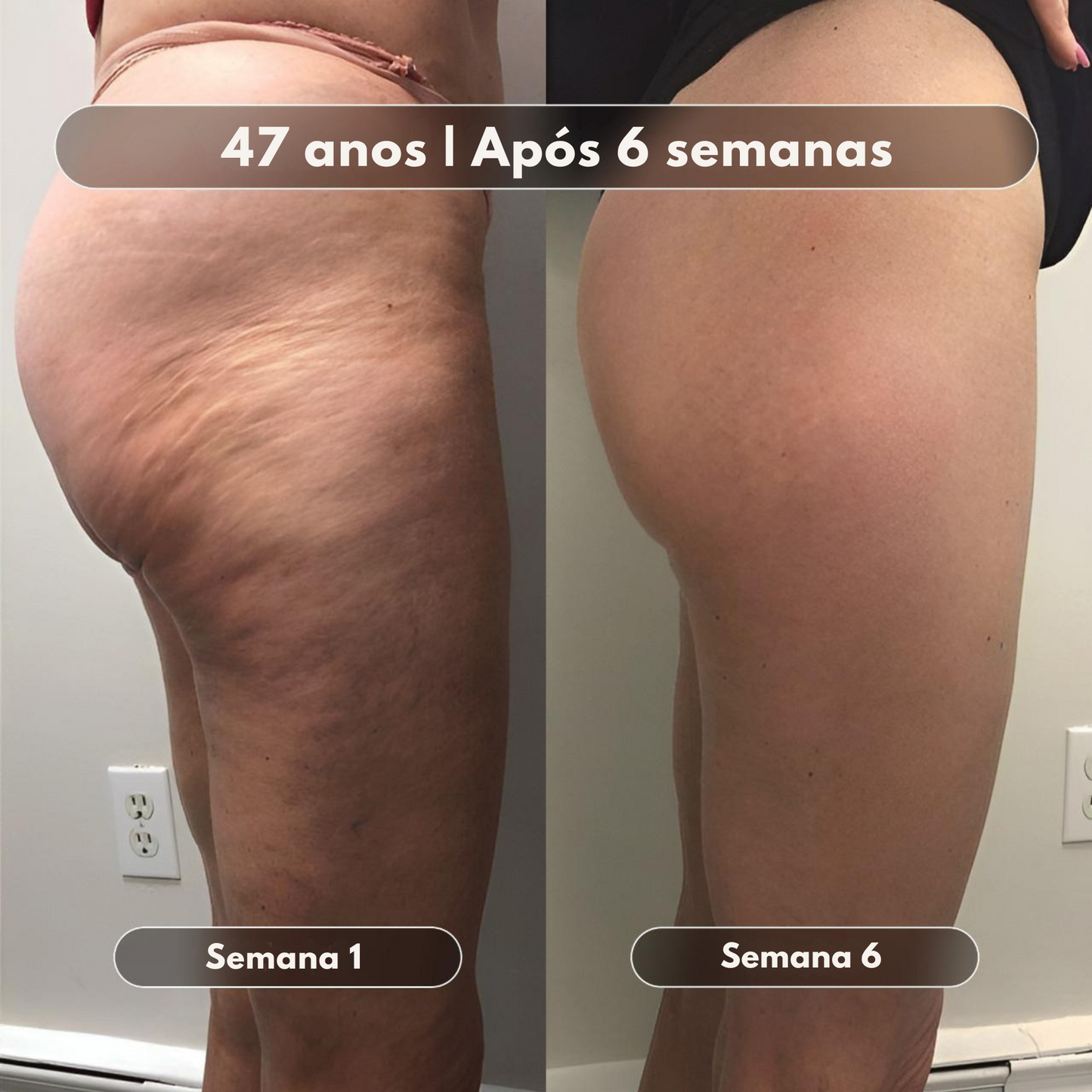 Óleo de Massagem Anticelulite