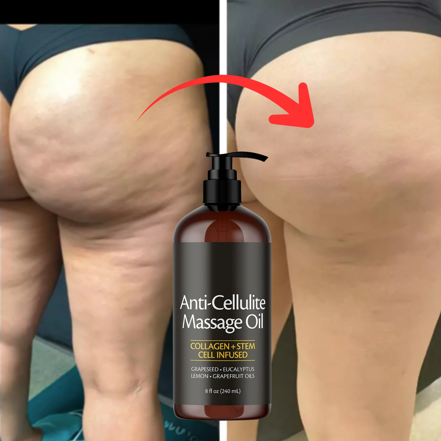 Óleo de Massagem Anticelulite