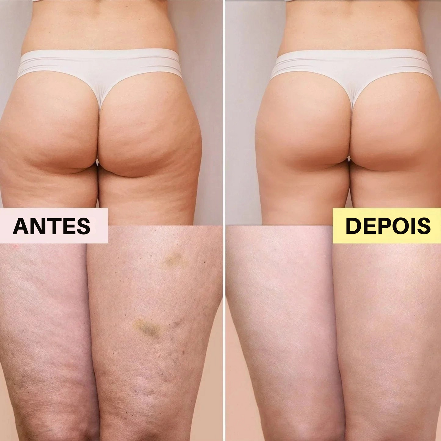 Óleo de Massagem Anticelulite