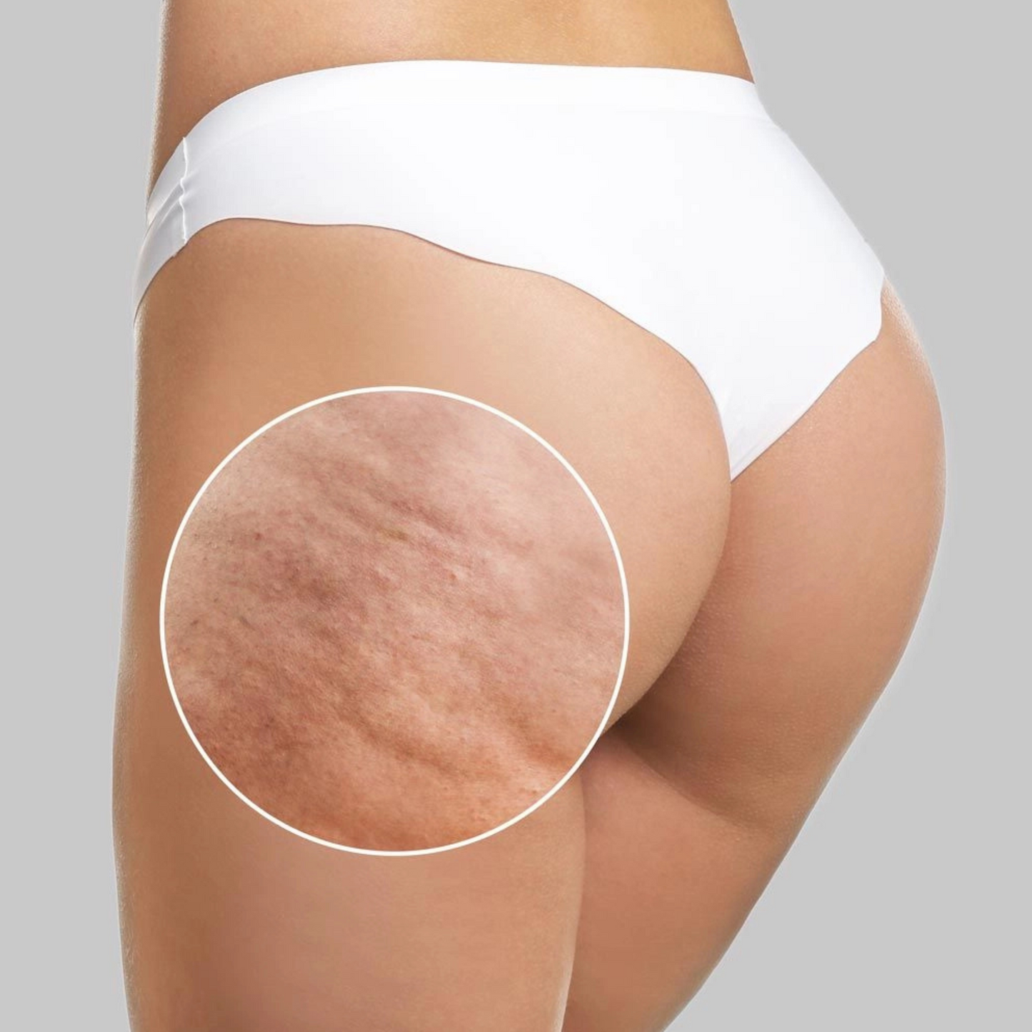 Óleo de Massagem Anticelulite