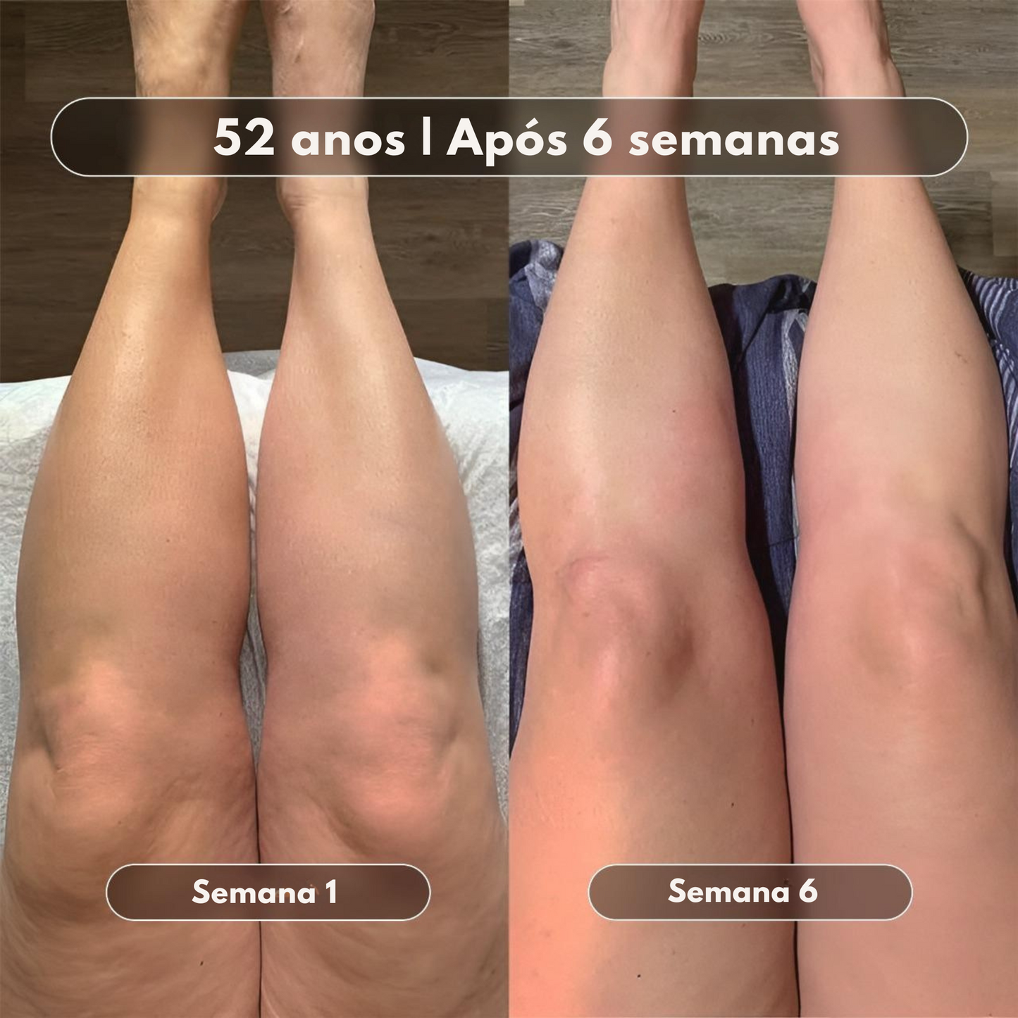 Óleo de Massagem Anticelulite