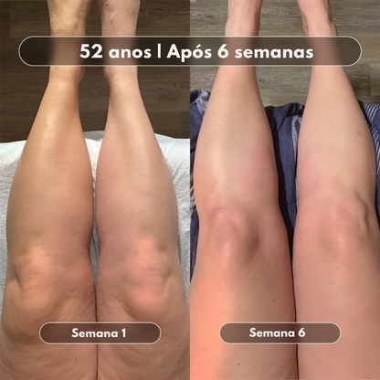 Óleo de Massagem Anticelulite