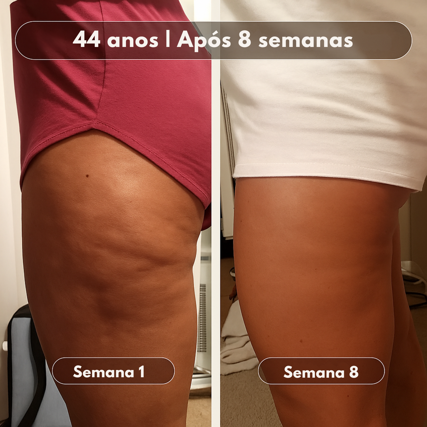 Óleo de Massagem Anticelulite