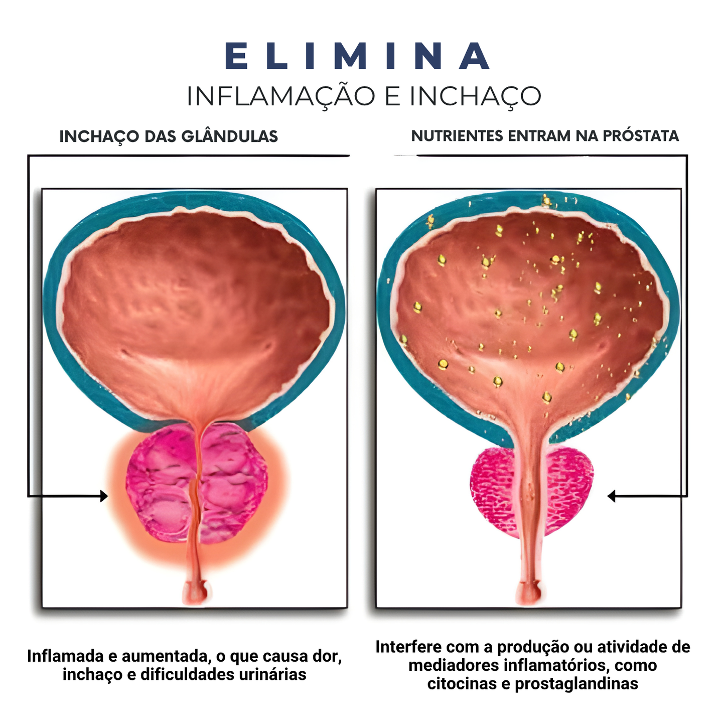 ProstaFlow PRO - Pulverizador Nasal de Alívio Rápido para a Próstata